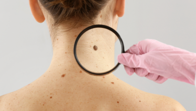 Photo of Investigación, la clave para acabar con el cáncer de piel más agresivo