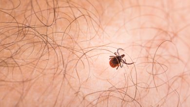 Photo of La proliferación de garrapatas por el cambio climático multiplicará los casos de Lyme