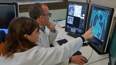 Photo of La Región registra casi novecientos nuevos casos anuales de cáncer de pulmón